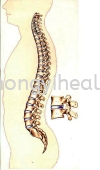 ؼ/Spinal Diseases ؼ/Spinal Diseases