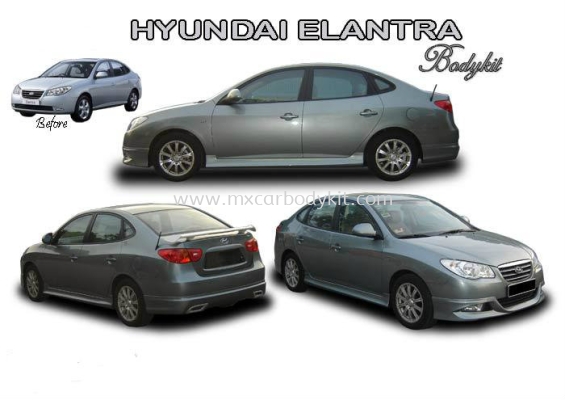 HYUNDAI ELANTRA 2007 AM STYLE BODYKIT