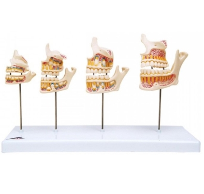 Dentition Development