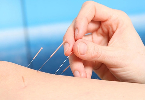 Acupuncture Health Care ı Acupuncture Health Care ı