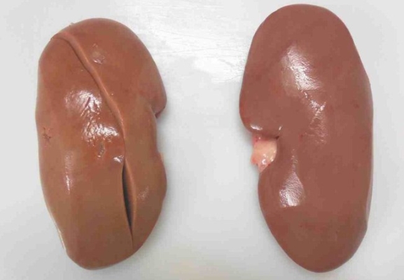 KIDNEY 