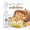 Acne Serum ACNE & OILY SERIES ODM / OEM