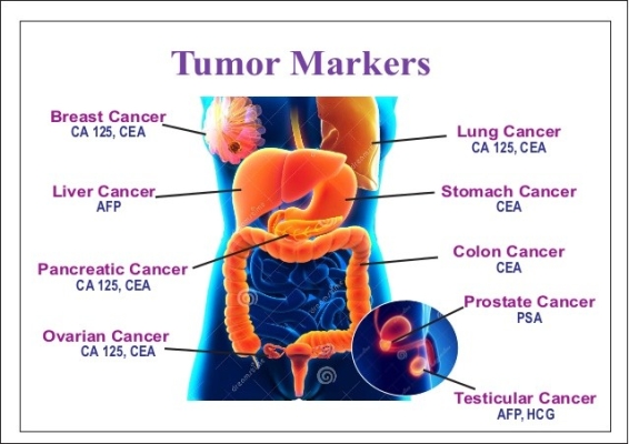 Tumor Markers