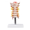  V.15 GIANT NECK VERTEBRAL COLUMN ;׵ģ V. Models ģ