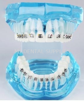 ORTHODONTICS MODEL WITH METAL BRACKET #M3001