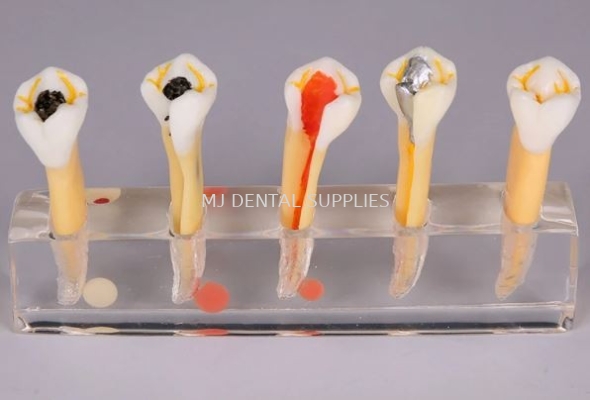 5 STAGE MODEL FOR ENDODONTIC TREATMENT #M4007