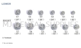 KIDS CROWN - STAINLESS STEEL PRIMARY MOLAR CROWN LOWER RIGHT Pediatrics Dentistry Material