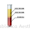 Platelet Rich Plasma (PRP) Facial PRP Treatment 