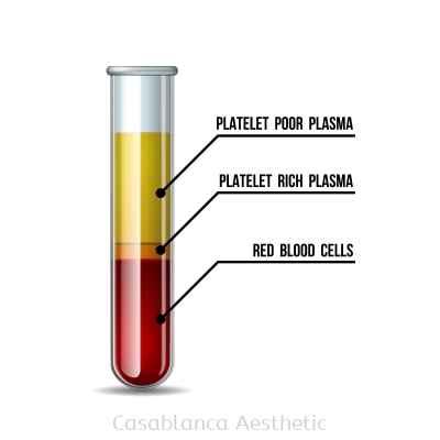 Platelet Rich Plasma (PRP) Facial