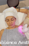 Diode Laser Hair Removal ë