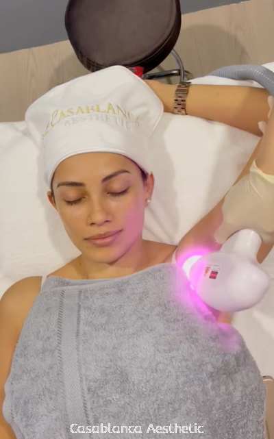 Diode Laser Hair Removal