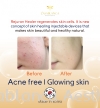 Rejuran Baby Skin Booster Rejuran Baby Skin Facial Aesthetic Services