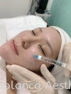 Rejuran Baby Skin Booster Rejuran Baby Skin Facial Aesthetic Services