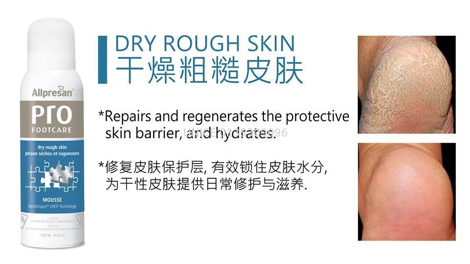 Allpresan PRO Footcare Mousse, dry rough skin (4.23oz 125ml) Foot Care NAIL  CARE Johor Bahru (JB), Malaysia Supplier, Wholesaler | UNICE MARKETING SDN  BHD