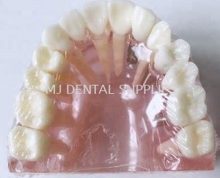 IMPLANT MODEL, #M2008