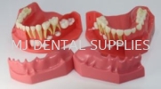 PEDIATRIC DEVELOPMENT MODEL AGE 3-6, #M7011 Standard Tooth Model Dentistry Material