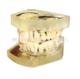 MALOCCLUSION ORTHODONTIC MODELS 10 KINDS, #M3014