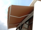  Retractable Awnings