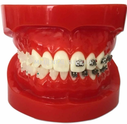 HALF METAL & HALF CERAMIC ORTHODONTICS MODEL, #M3003