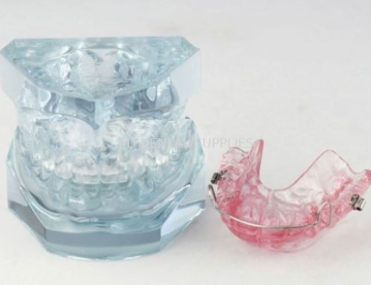 ORTHODONTIC TREATMENT MODEL, #M3006