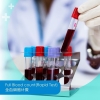 General Information on Blood Test Blood Test