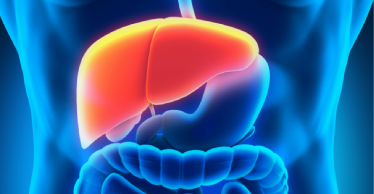 Have EXTRA Fats In Your Liver? Beware of Liver Failure!