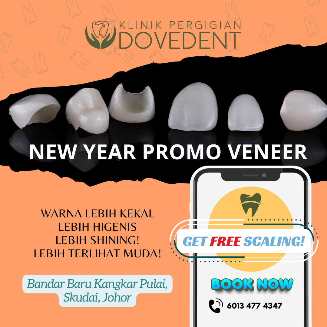 DoveDent's New Year Offer: Veneers