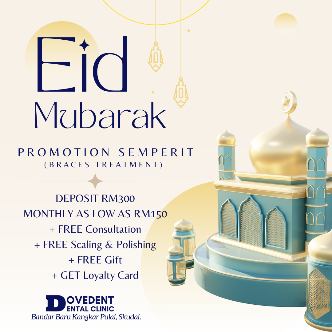 Promosi Semperit Eid Mubarak  2024