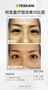 Neopenmed + Toskani mesoserum (ECPR) NeopenMed + Toskani mesoserum Facial Treatment Services