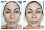 Neopenmed + Toskani mesoserum (ECPR) NeopenMed + Toskani mesoserum Facial Treatment Services