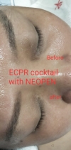 Neopenmed + Toskani mesoserum (ECPR) NeopenMed + Toskani mesoserum Facial Treatment Services