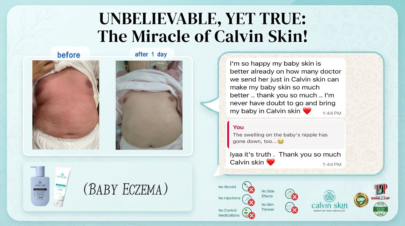 Baby Eczema Skin Improvement Journey