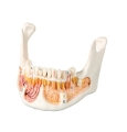 Human Skull Model, with Opened Lower Jaw, 3 Part