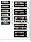 Vertex 5 Layer Quint Teeth Quint teeth Vertex