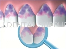 MIRA-2-TON® DISCLOSING TABLET, 250PCS Oral & Denture Care Dentistry Material