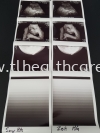 Ultrasound Paper USP-110HG Ultrasound Paper Imaging Accessories