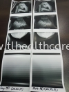 Ultrasound Paper USP-110HD Ultrasound Paper Imaging Accessories