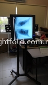 X-ray Viewer Slim Type Medical Equipment