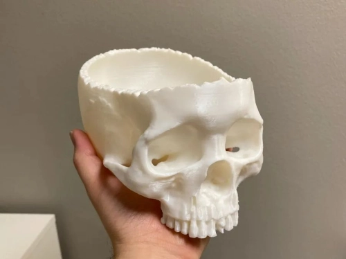 3D Printed Skeleton Modelling For Medical Visualization Use