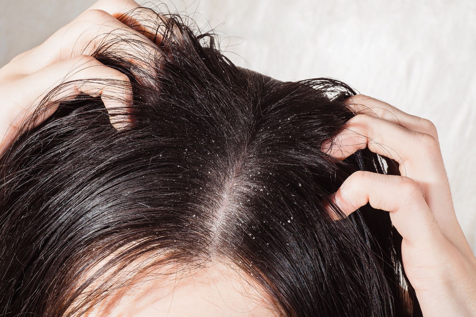 Hair Growth Scalp Treatment