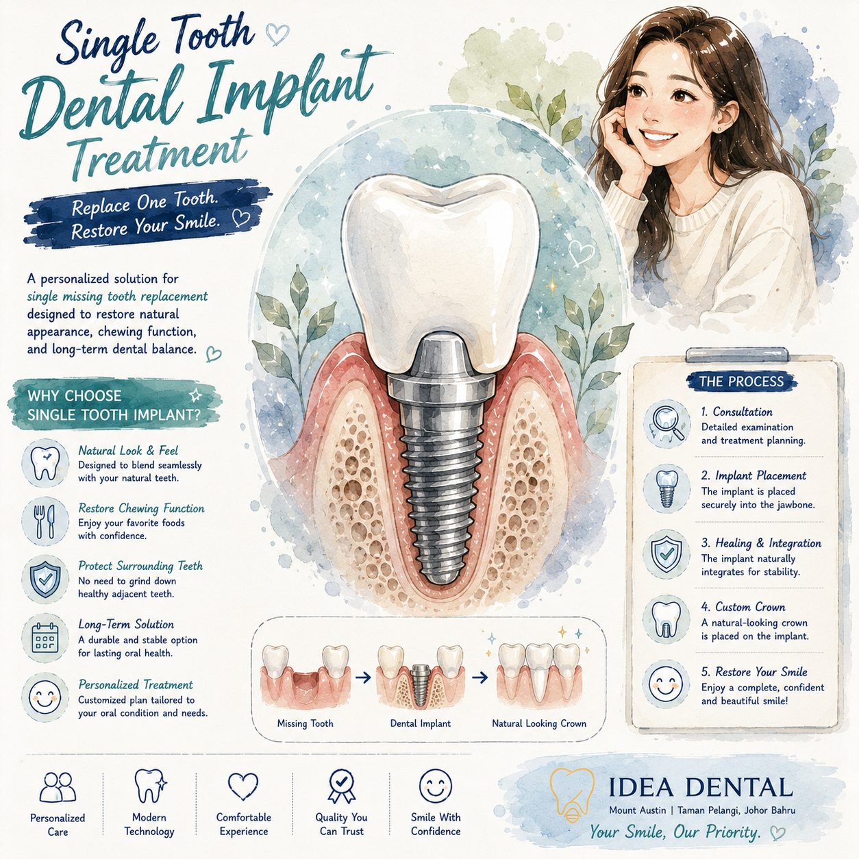 Single Tooth Dental Implant Treatment