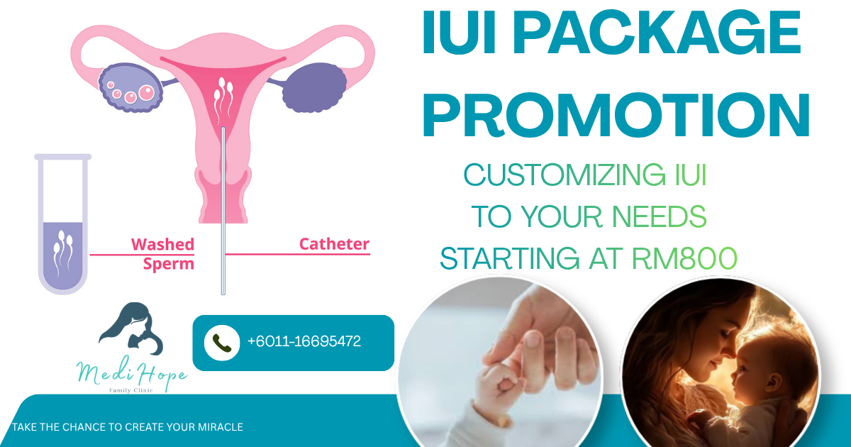 IUI for trying to conceive (Intrauterine Insemination)