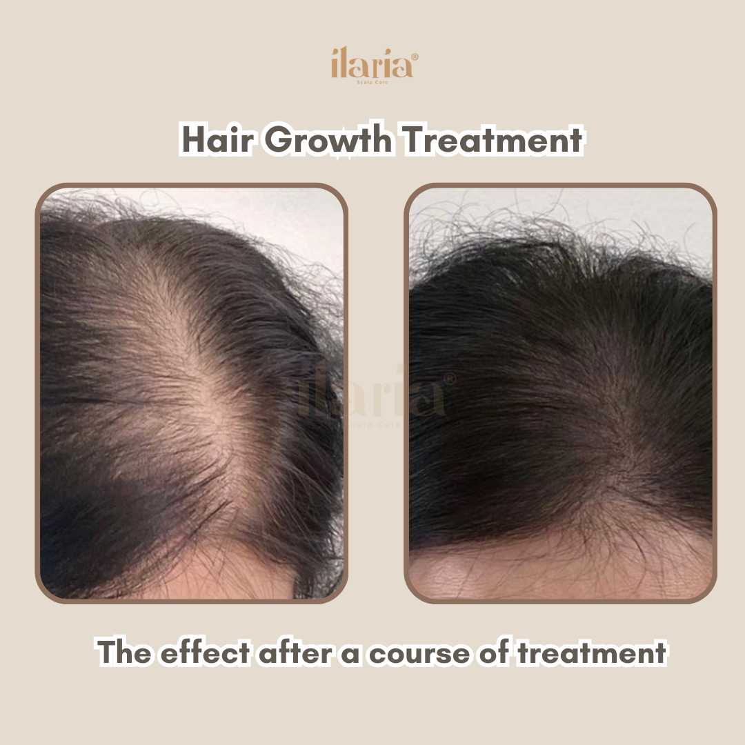 Hair Growth Results 3 & Head Health Sdn Bhd