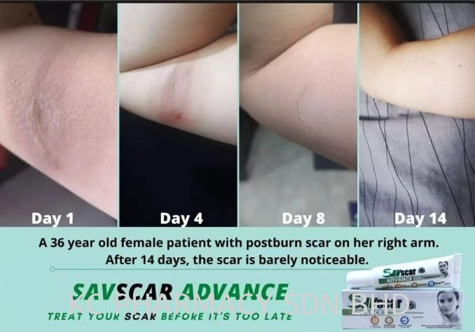 (NEW PRODUCT) SAVSCAR ADVANCE SCAR CREAM 15G