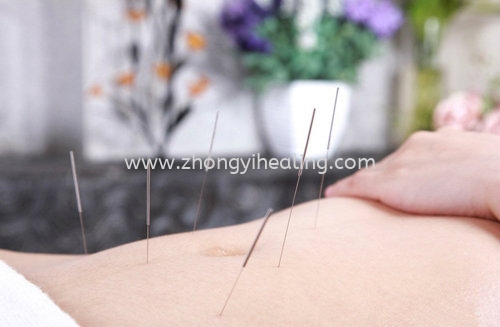 ļ ļ Kuala Lumpur, KL, Cheras, Selangor, Malaysia. Traditional Chinese Medicine, Acupuncture, Joint Pain, Arthritis, Arthralgia, Slimming, Period Pain | Yik Shou Enterprise