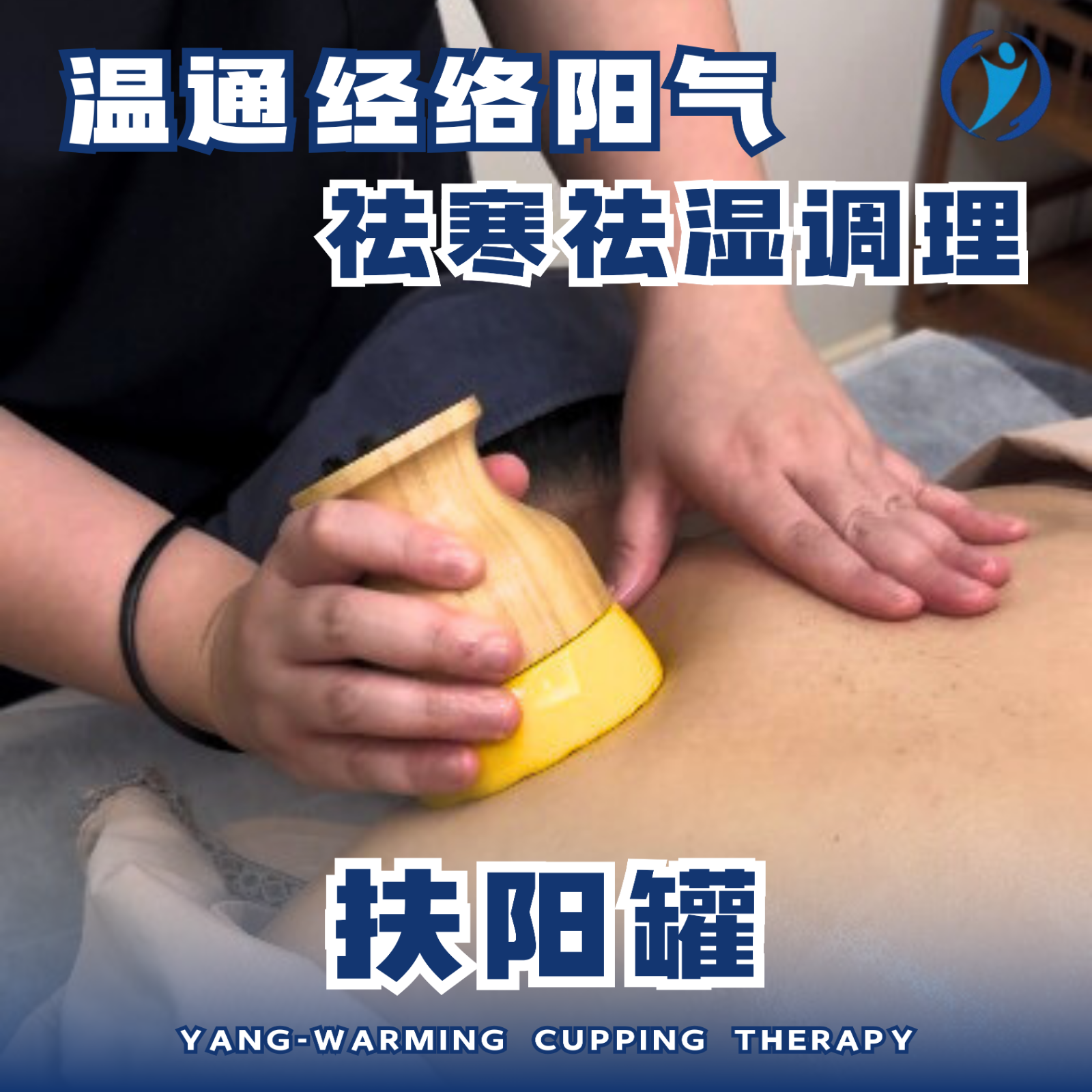 扶阳罐