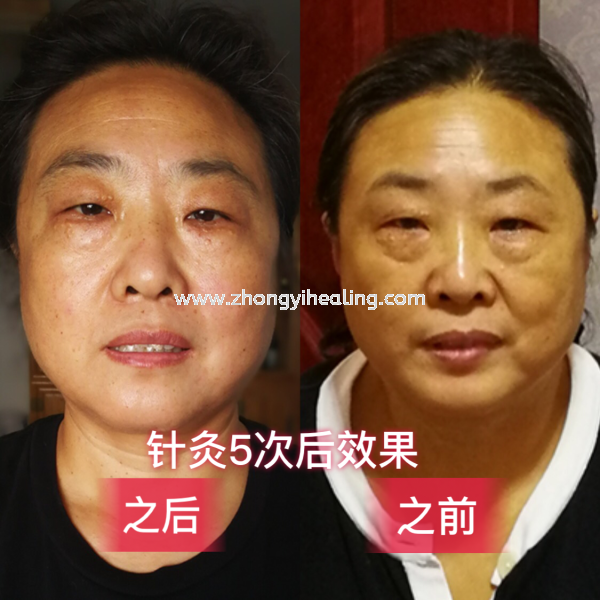 |۴ Ҿ Kuala Lumpur, KL, Cheras, Selangor, Malaysia. Traditional Chinese Medicine, Acupuncture, Joint Pain, Arthritis, Arthralgia, Slimming, Period Pain | Yik Shou Enterprise