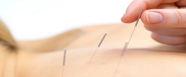 Acupuncture    Service, Treatment, Specialist, Centre | Golden Gate Fertility Centre