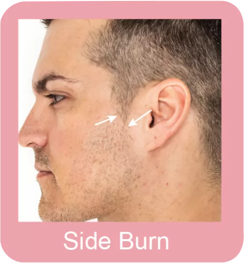 Side Burn