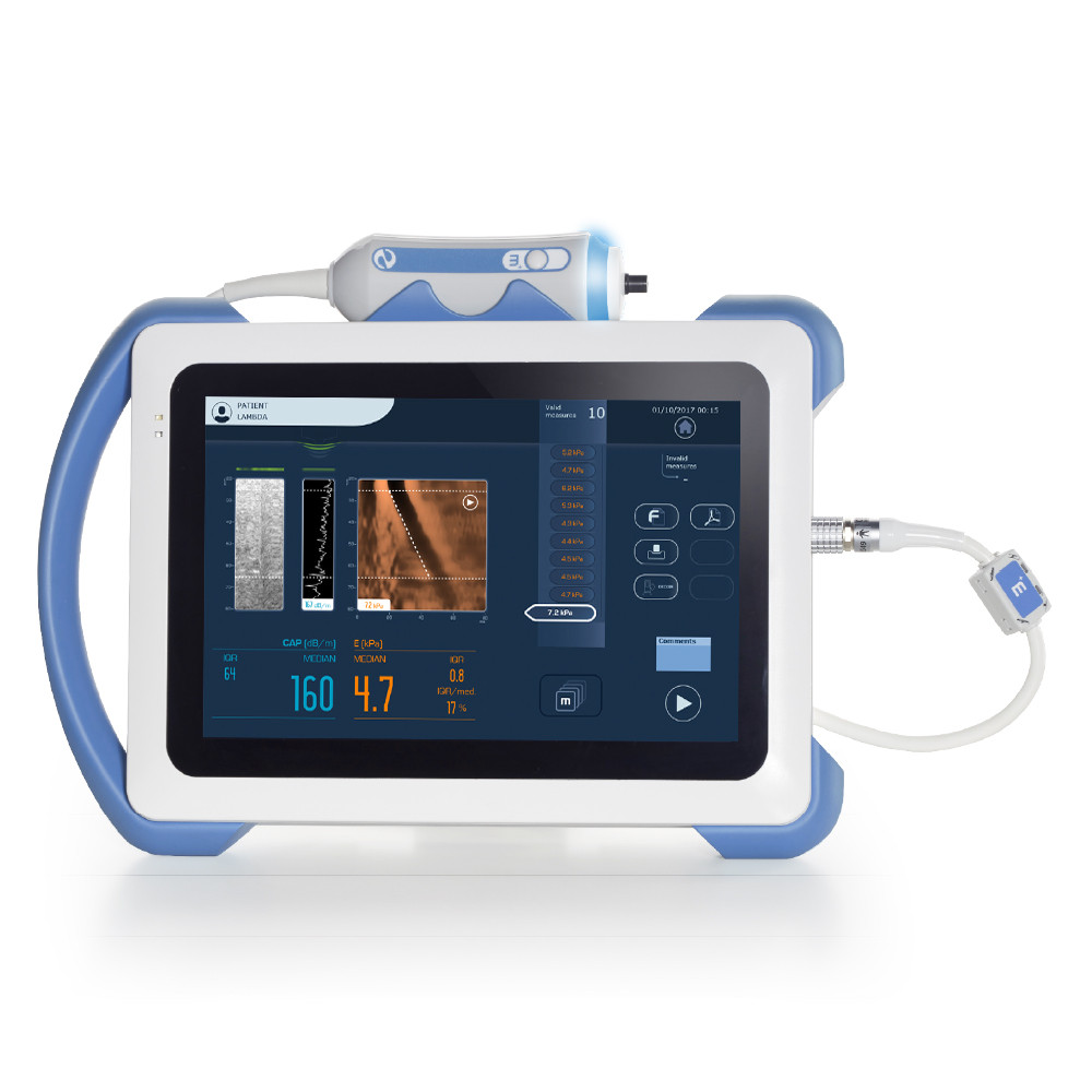 FibroScan® Mini+ 430